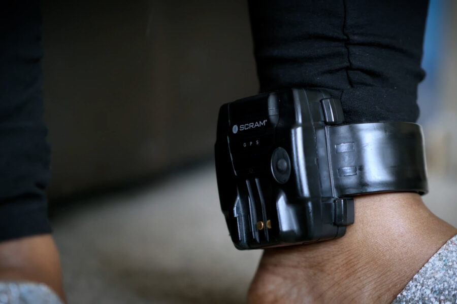 A close-up of a person's electronic monitoring bracelet on their ankle.