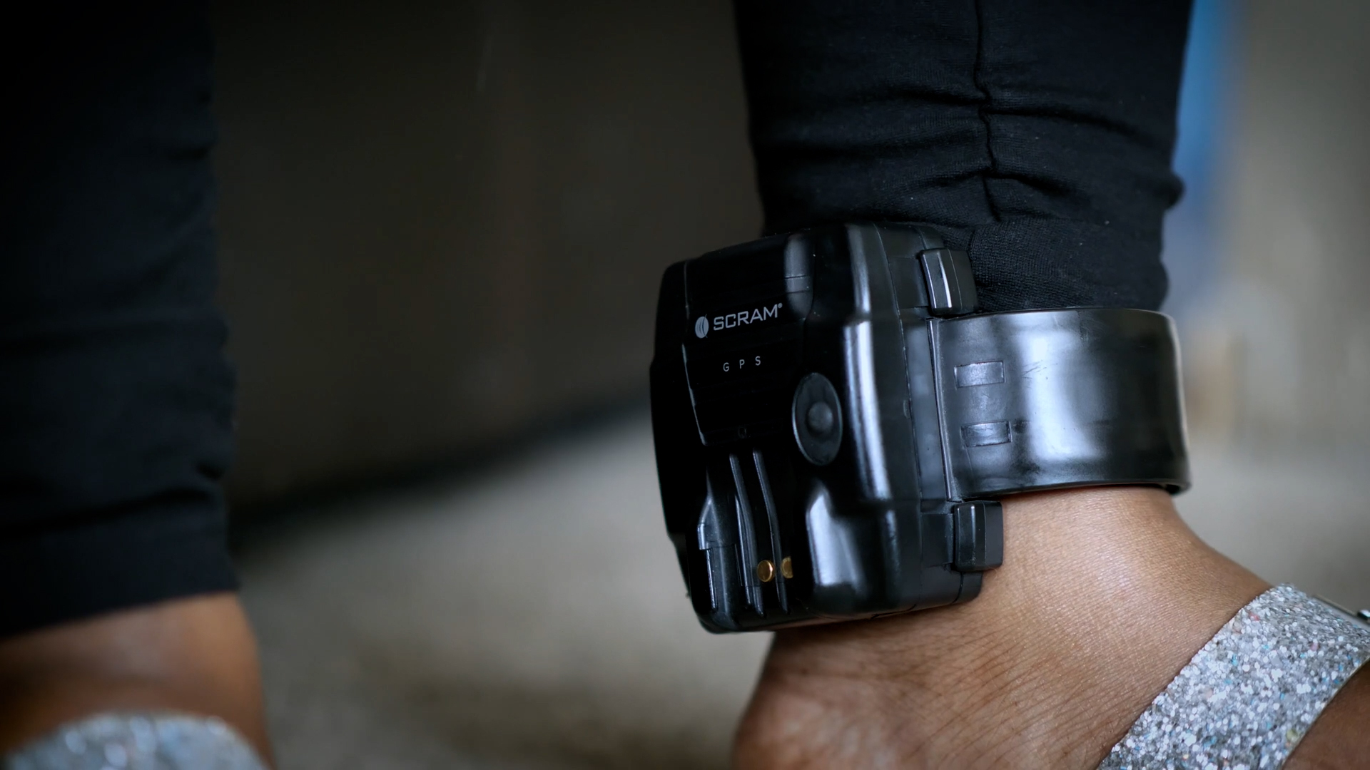 A close-up of a person's electronic monitoring bracelet on their ankle.